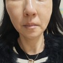샤방샤방 | 올리브영 추천 잡티 흔적 세럼으로 샤방샤방한 피부