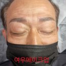 여우눈썹 이미지