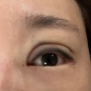 대운 동물병원 | 모두 다말렸는데 강행한 자연유착 내돈내산후기