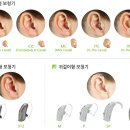 열린보청기 검단점 이미지