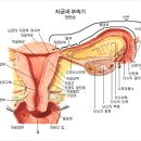 여성질병의 종류 이미지