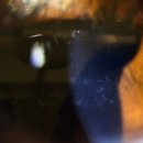 더연세안과의원 이미지