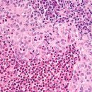 오름한의원 이미지