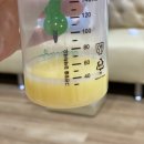 양수1 | 부산 순병원 제왕절개 1인실 후기, 양수 부족으로 38주 3일에 태어난 아기