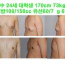 24세 대학생 170cm 73kg 중간 사이즈 여유증 이미지