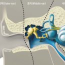 한음보청기 이미지