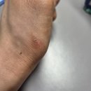 스포츠 라이트 | 크로스핏 손바닥 보호대, 그립 추천, 스포츠 1번가 MXFLEXI 그립 라이트 베이지 S 후기