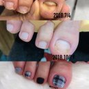 빛나요네일