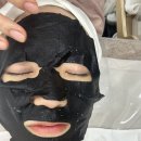 이브 | 예신 스킨 피부 피지관리 수원 에너지테라피 “에스떼이브” 후기