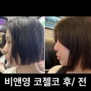 비앤영의원 | [비앤영의원] 코젤코 수술 솔직후기 🫢 수술 당일부터 3일차까지 변화 기록!