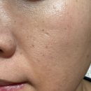 큐리코 | 큐리케어 펄즈(PulZ) 정품주파수 물방울초음파 EP 결합 디바이스 솔직 후기