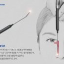 누도 이미지