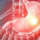 휘트니스 트리 이미지