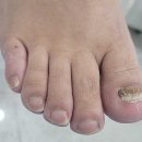 빛나러오소 문제성 발관리 계양구청점 이미지