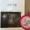 [임신기록] 임신 준비 과정 | 임신 확인(아기집~심장소리) | 임밍아웃👶🏻