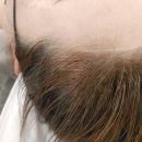 영헤어라인 이미지