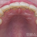 인비스치과의원 이미지