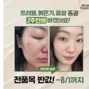 굽네치킨(송악점) | 밀크터치 서양송악 진정크림, 피부 진정, 피부 거칠기, 피부 온도 , 000개선 등 기적의 피부 진정 효과...