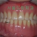 나무하나치과 이미지
