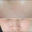 주식회사 약사친구 | 백옥주사 효과 효능 전후 비교 후기 (+꿀팁)