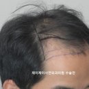제이제이서연외과의원 네이버블로그
