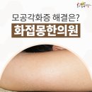 오수정헤어 - 제주시 | 강서구 팔모공각화증/닭살 /붉은기/빨간점/색소침착/ 가려운 모공각화증, 피부한의원에서 깨끗하게 해결~!