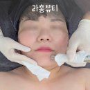 라홍뷰티 | 노은동 피부관리샵 라홍뷰티, 케라손 관리로 피부 컨디션 되찾기