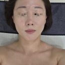 뷰티유스 | 울산 피부관리 여드름관리 추천｜북구 상안동 유스스킨&뷰티 1:1 맞춤 에스테틱 후기