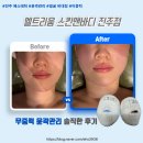 6167 | 진주 에스테틱, "엘트리움 스킨앤바디 진주점" 무중력 윤곽관리 후기