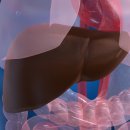 지방간의 진단과 관리 이미지