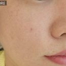 샵레오네
