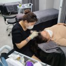 오즈헤어라인 이미지