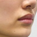 벨리스 성수 의원, 결과로 증명하는 피부과