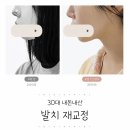 바롬의원 | 30대 발치 재교정 1년 경과 기록 (내돈내산 후기)