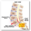 전방