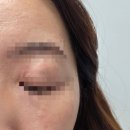 갑자기 생긴 전신 두드러기 치료기 (2)대학병원 가기 전 진행과정