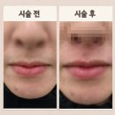 원모어짐 | 브로우바] 베네피트 브로우 바 출신 원장님의 1:1 케어!아프지 않고 깔끔한 눈썹 맛집 '원모어' 솔직 후기