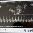 [임신 8-11주] 입덧 그리고 밥풀댄스