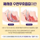 수면 무호흡증 Sleep apnea 이미지