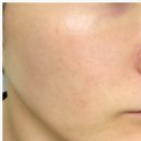 [라시뎀, LACIDEM] 라시뎀 오토이뮨시스템 피토 엑소좀 AC-W 앰플, 바른 듯 안 바른 듯 가볍고 자연...