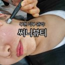 써니 뷰티 | 부천 상동 피부관리 맛집 써니뷰티, 크레이지 고주파 리프팅 후기