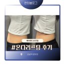 현이피부관리 | 강남역 피부과 복부 온다리프팅 솔직후기