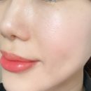 청담포레브의원 | 청담피부과 포레브의원 내돈내산 엑소좀 스킨부스터 시술 효과 통증 후기
