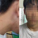 “늦잠 자서” 8분 지각에…고3 목 조르고 뺨 때린 교사 이미지