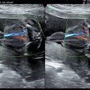 H(합덕)-HL-12 | [임신일기] 임신 20주차 | 인천 아인병원 2차 정밀 초음파 후기, 초음파 용어 정리, 잘 자라고 있는 만두👶🏻