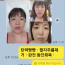 다운에이징자연성형연구소