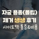 자궁 용종 제거 후기, 사이토텍 통증부터 자궁경 비용, 실비처리까지(자궁 폴립 제거 수술)