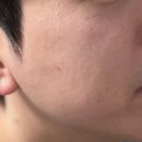 더모이라 | 코르테 선크림 여드름 피부 내돈내산 후기 (+비교, 성분, 톤업, 더모 혼합자차 선쉴드)