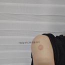 건강제일의원 | JH제일의원 :: 25년 국가건강검진 후기 및 가다실 9가 3차 (비용/부작용)