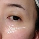 꽃결피부 이미지